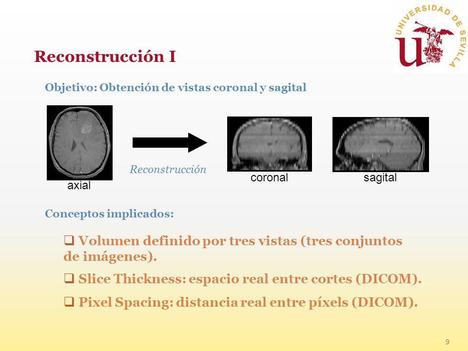 Reconstrucción I Objetivo: Obtención de vistas coronal y sagital. Reconstrucción. axial. coronal.