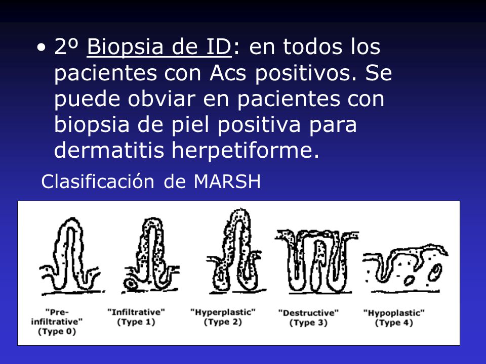 2º Biopsia de ID: en todos los pacientes con Acs positivos