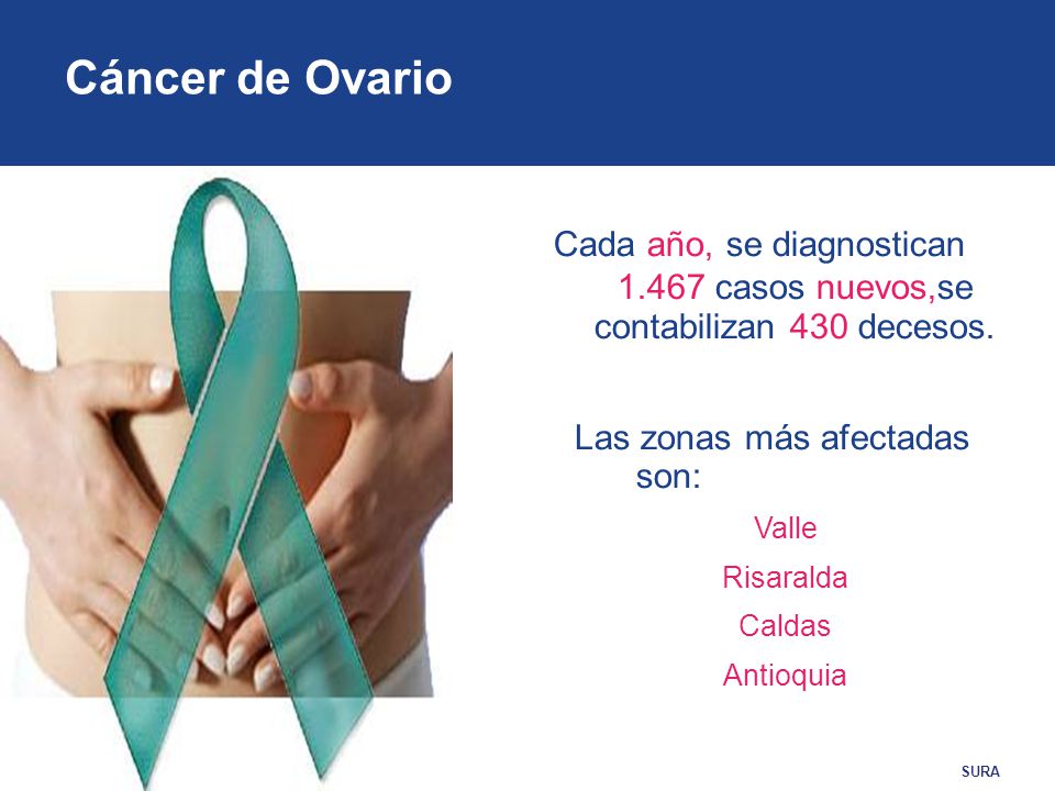 Cáncer de Ovario Cada año, se diagnostican casos nuevos,se contabilizan 430 decesos. Las zonas más afectadas son: