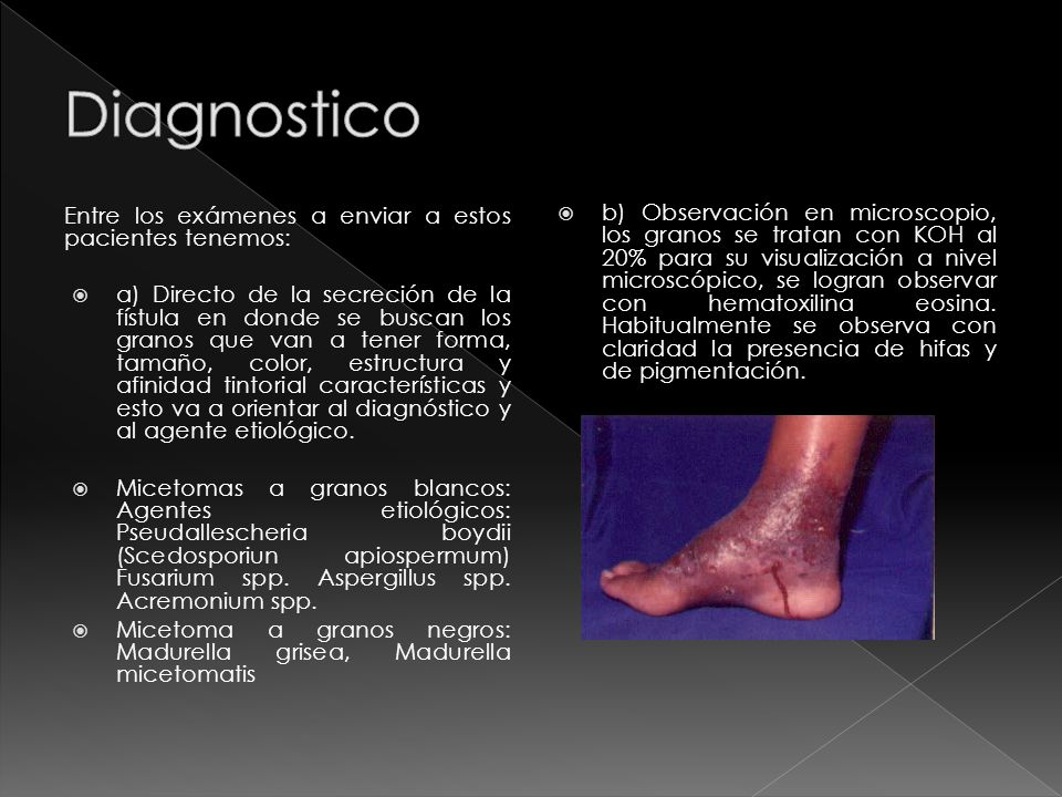 Diagnostico Entre los exámenes a enviar a estos pacientes tenemos: