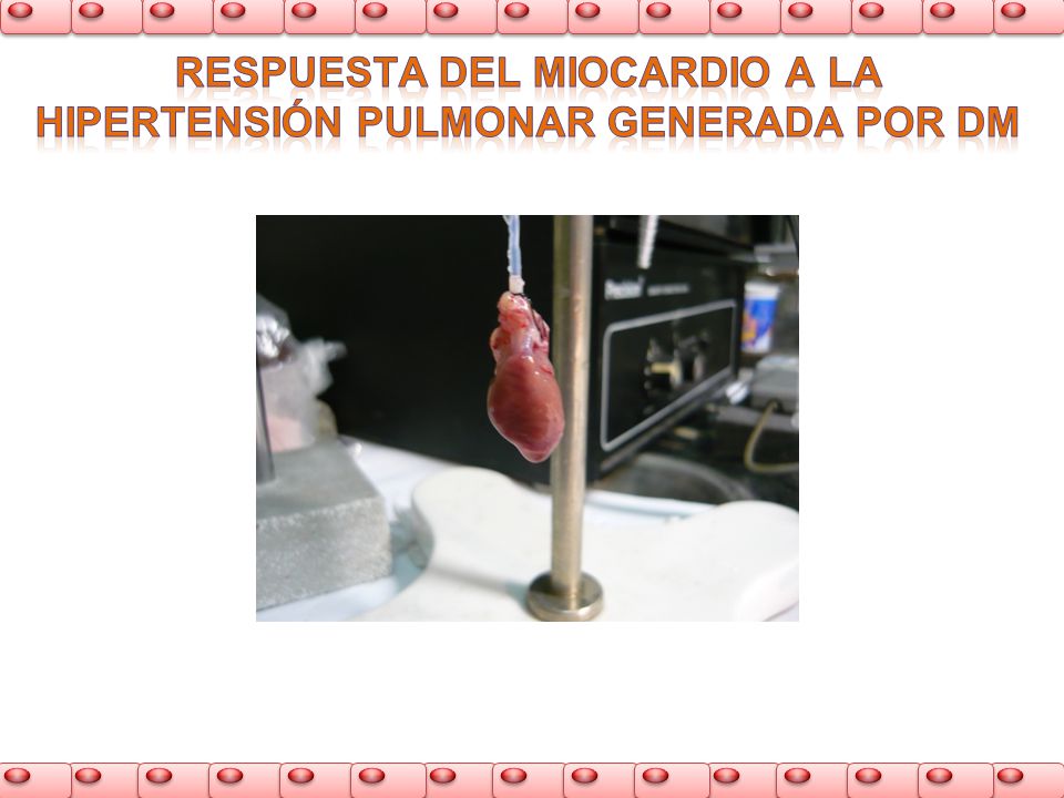 Respuesta del miocardio a la hipertensión pulmonar generada por DM