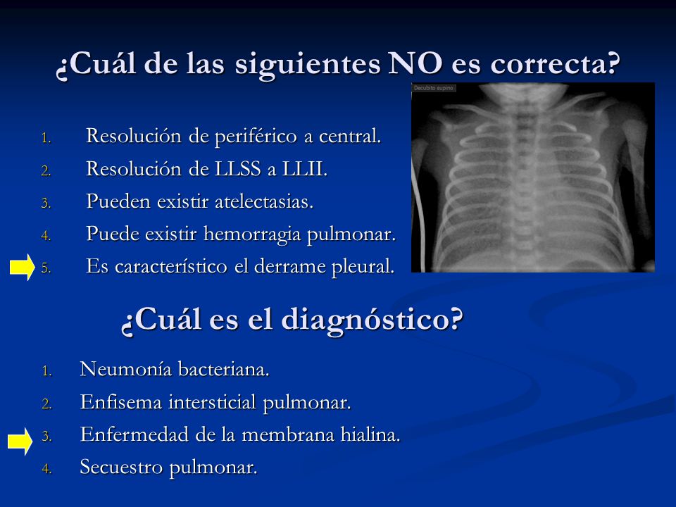 ¿Cuál de las siguientes NO es correcta