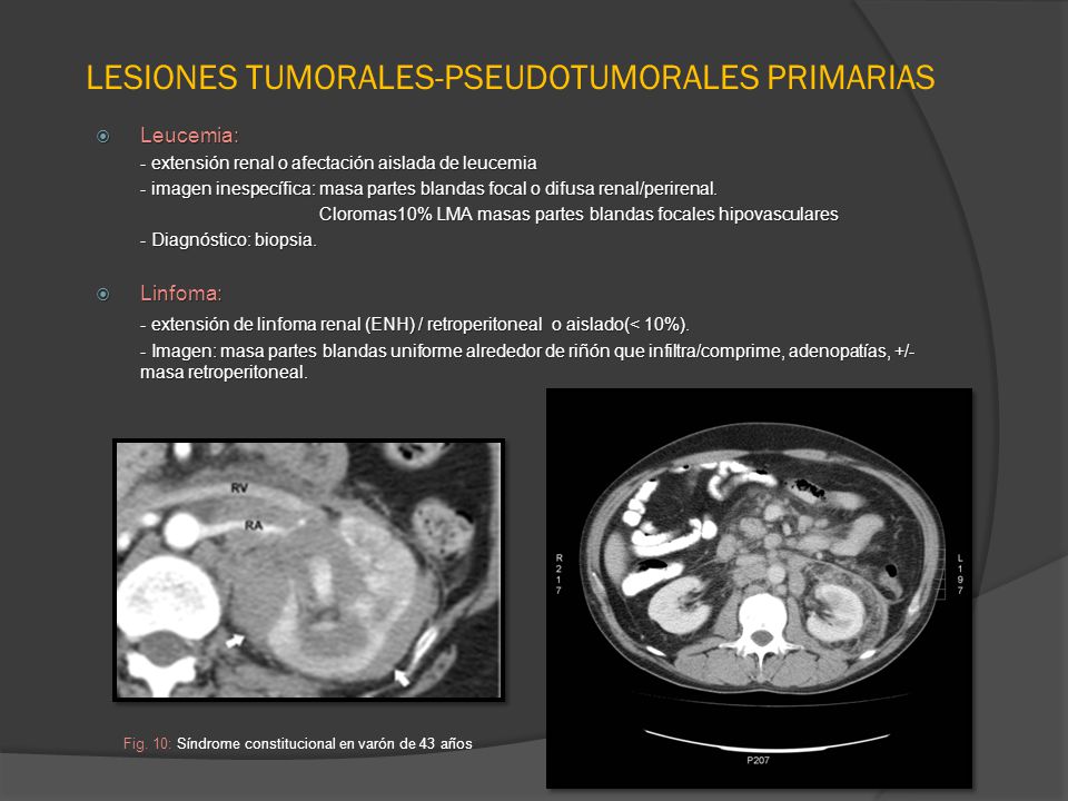 LESIONES TUMORALES-PSEUDOTUMORALES PRIMARIAS