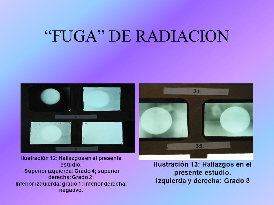FUGA DE RADIACION Ilustración 13: Hallazgos en el presente estudio.