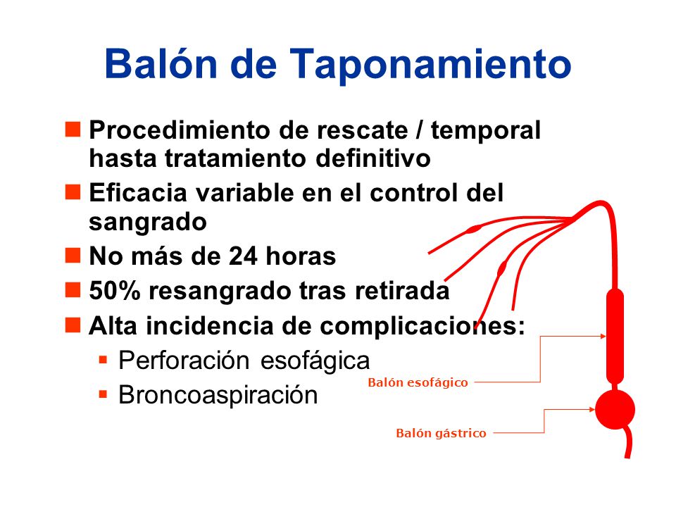 Balón de Taponamiento Procedimiento de rescate / temporal hasta tratamiento definitivo. Eficacia variable en el control del sangrado.