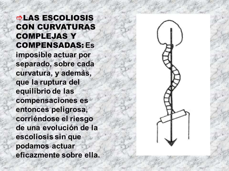 LAS ESCOLIOSIS CON CURVATURAS COMPLEJAS Y COMPENSADAS: Es imposible actuar por separado, sobre cada curvatura, y además, que la ruptura del equilibrio de las compensaciones es entonces peligrosa, corriéndose el riesgo de una evolución de la escoliosis sin que podamos actuar eficazmente sobre ella.