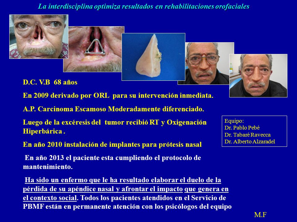 En 2009 derivado por ORL para su intervención inmediata.