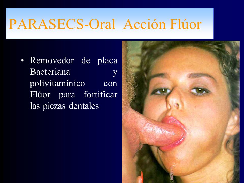 PARASECS-Oral Acción Flúor