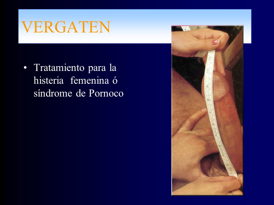 VERGATEN Tratamiento para la histeria femenina ó síndrome de Pornoco