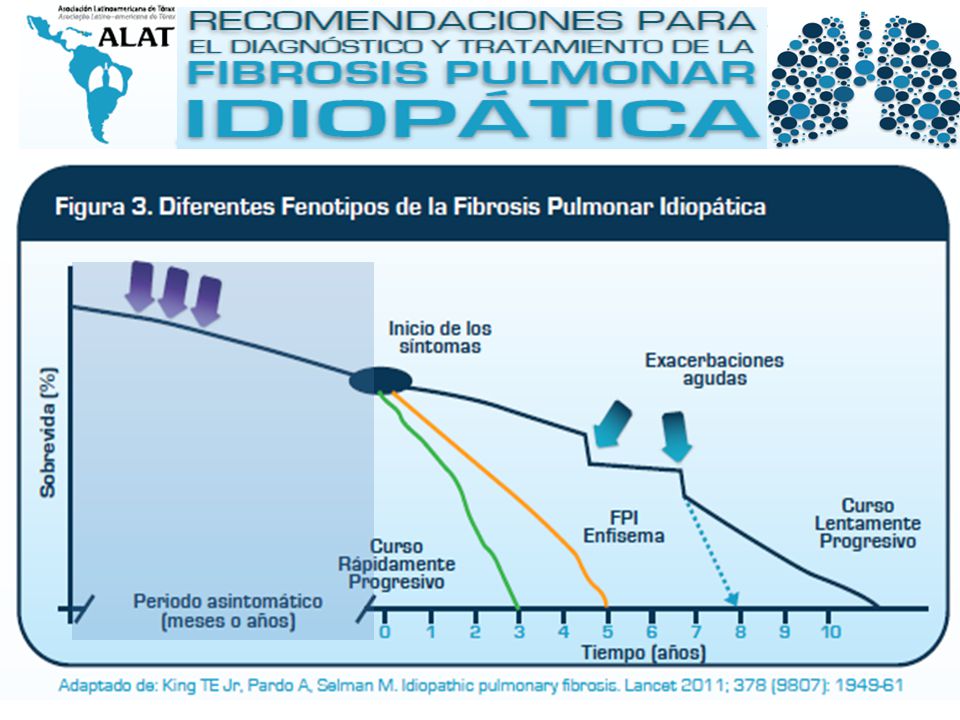 La FPI tiene generalmente un curso FATAL pero impredecible… Puede ser de progresión lenta o rápida.