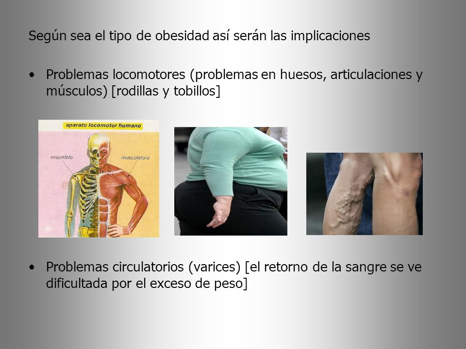 Según sea el tipo de obesidad así serán las implicaciones