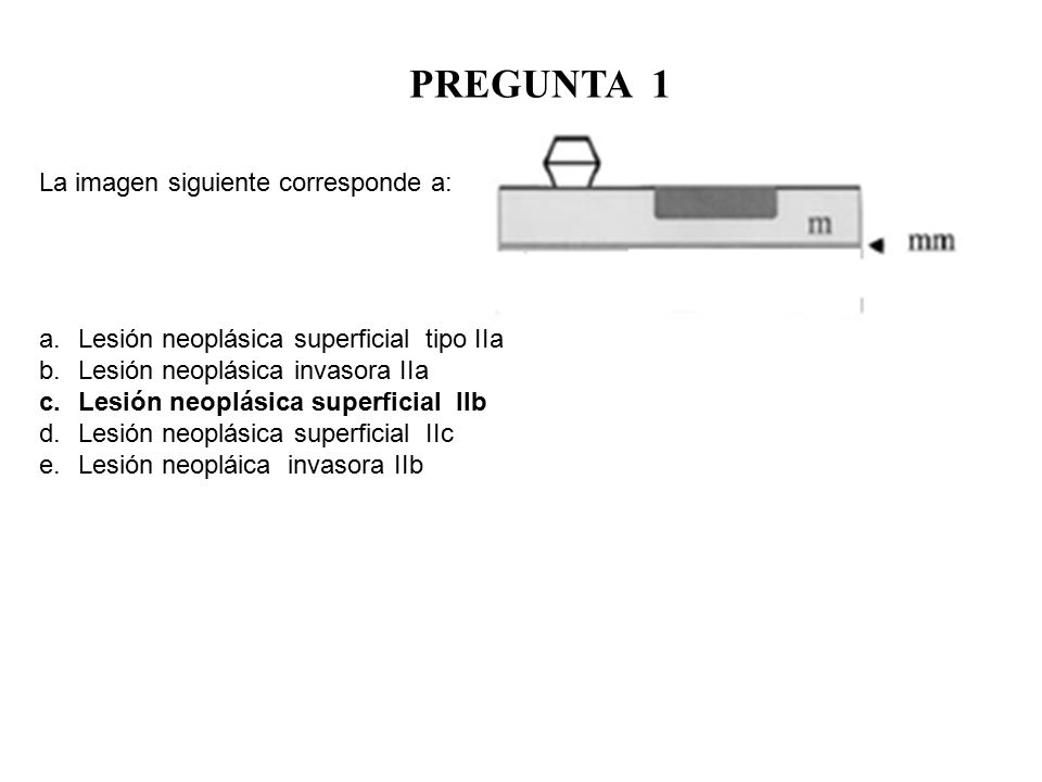 PREGUNTA 1 La imagen siguiente corresponde a: