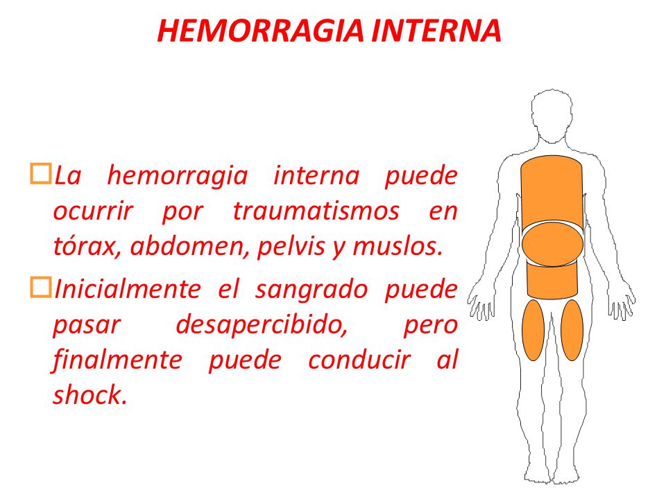 HEMORRAGIA INTERNA La hemorragia interna puede ocurrir por traumatismos en tórax, abdomen, pelvis y muslos.