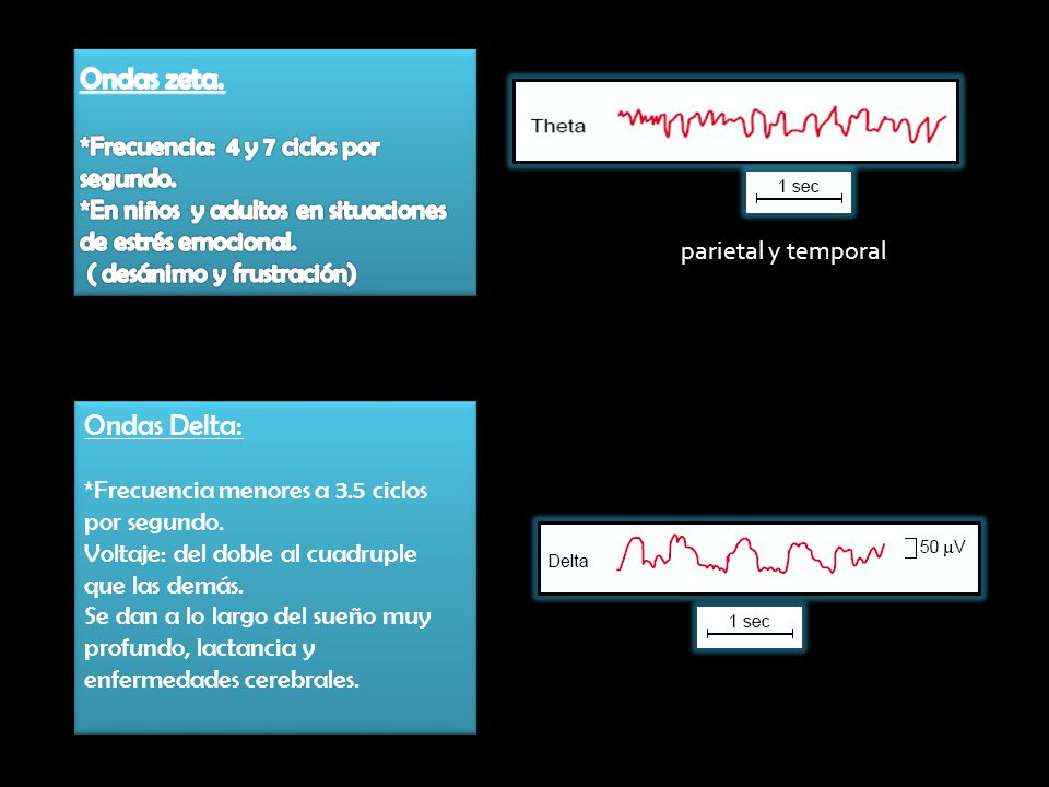 Ondas zeta. Ondas Delta: *Frecuencia: 4 y 7 ciclos por segundo.