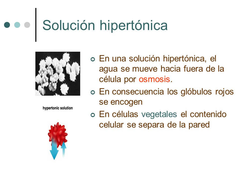 Solución hipertónica En una solución hipertónica, el agua se mueve hacia fuera de la célula por osmosis.