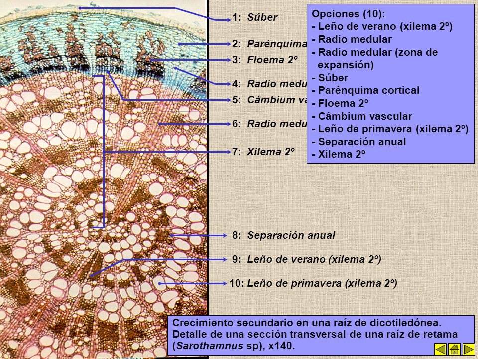 Opciones (10): - Leño de verano (xilema 2º) - Radio medular. - Radio medular (zona de expansión)