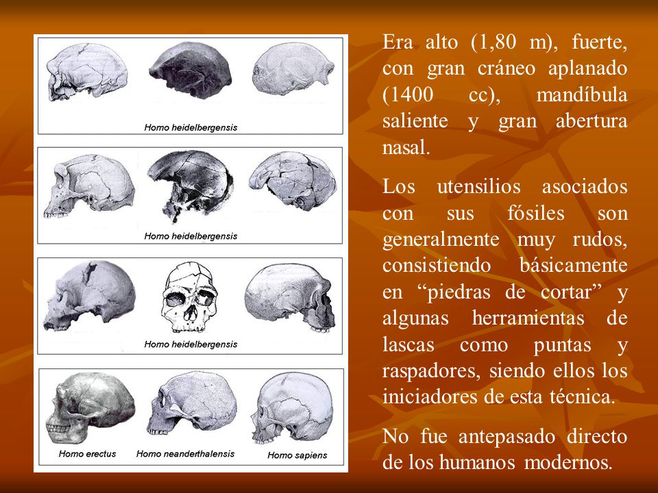 Era alto (1,80 m), fuerte, con gran cráneo aplanado (1400 cc), mandíbula saliente y gran abertura nasal.