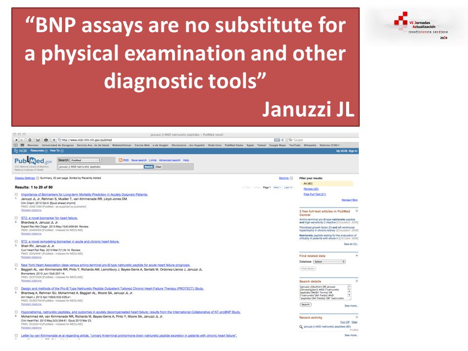 BNP assays are no substitute for a physical examination and other diagnostic tools