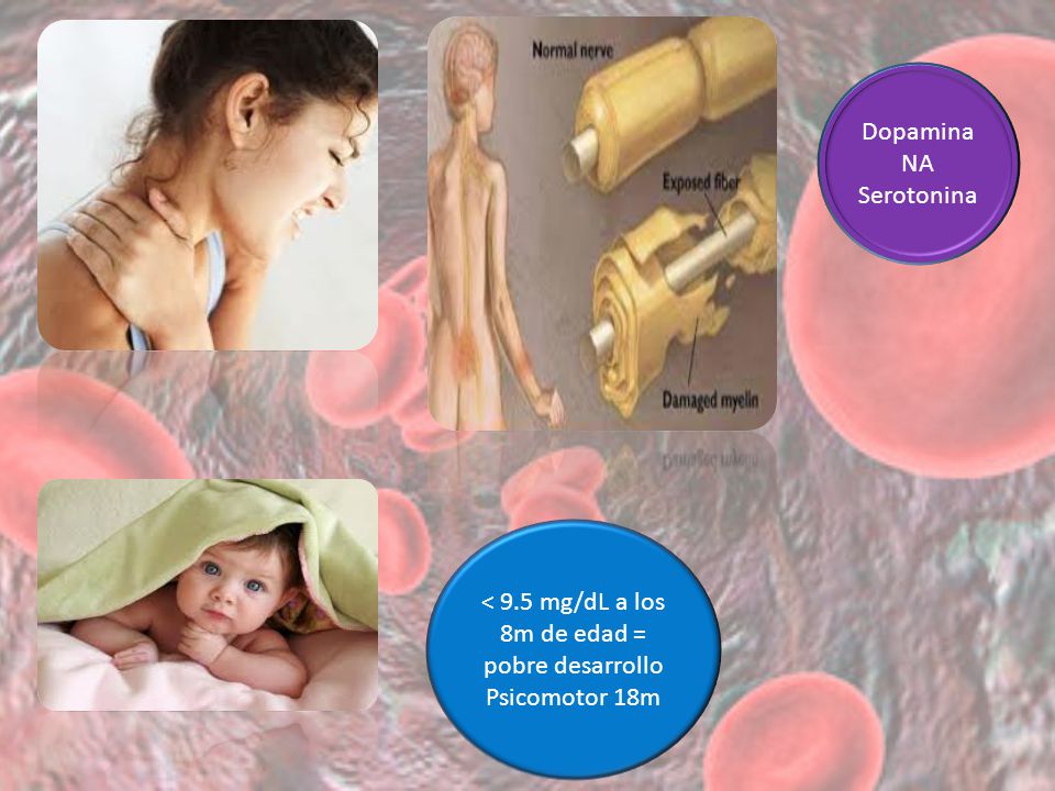 < 9.5 mg/dL a los 8m de edad = pobre desarrollo Psicomotor 18m