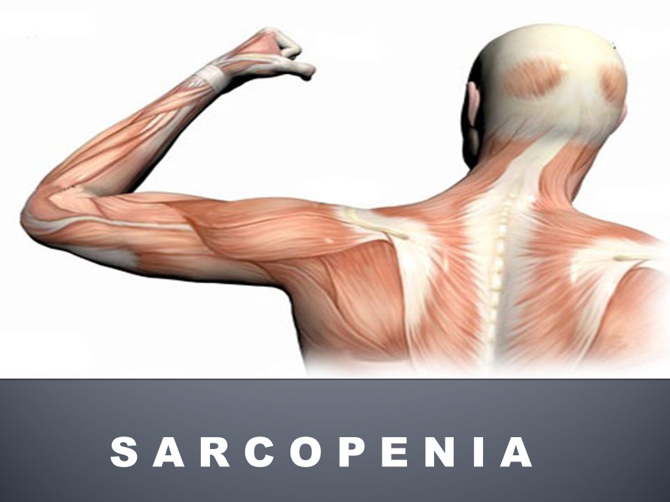 S A R C O P E N I A
