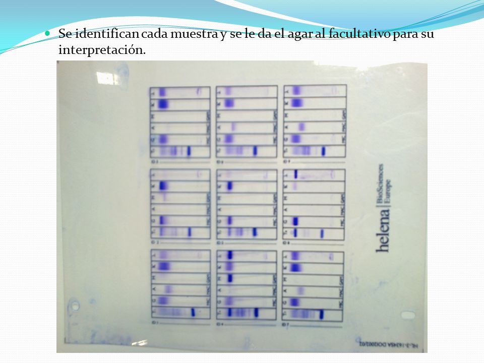 Se identifican cada muestra y se le da el agar al facultativo para su interpretación.