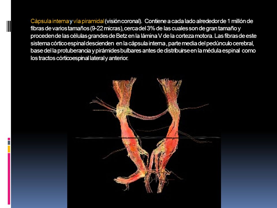 Càpsula interna y vía piramidal (visión coronal)
