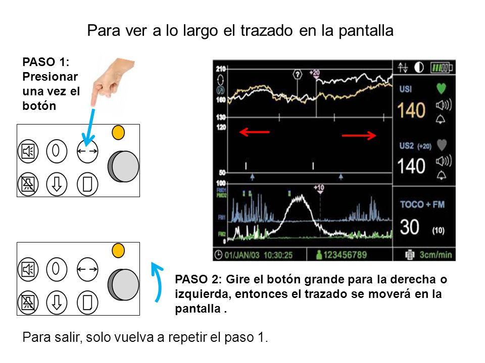 Para ver a lo largo el trazado en la pantalla