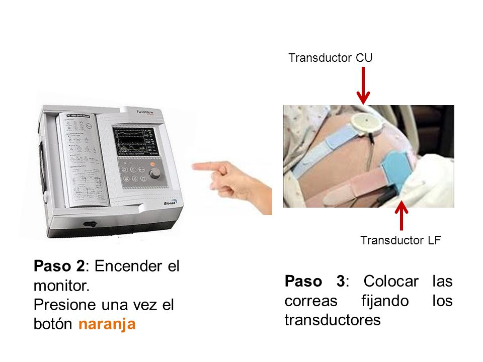 Paso 2: Encender el monitor. Presione una vez el botón naranja