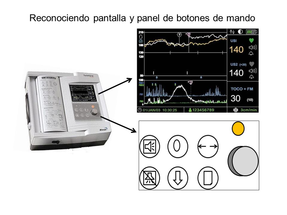 Reconociendo pantalla y panel de botones de mando