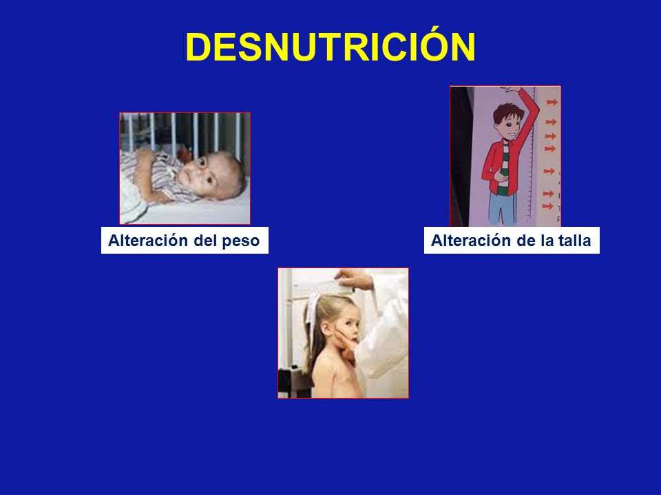 DESNUTRICIÓN Alteración del peso Alteración de la talla