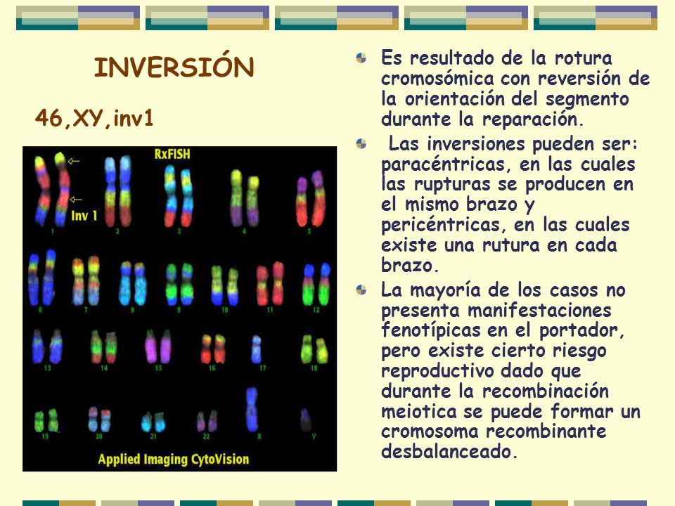 INVERSIÓN Es resultado de la rotura cromosómica con reversión de la orientación del segmento durante la reparación.