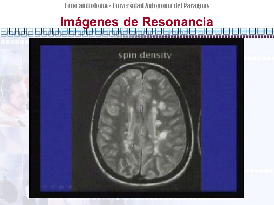 Imágenes de Resonancia