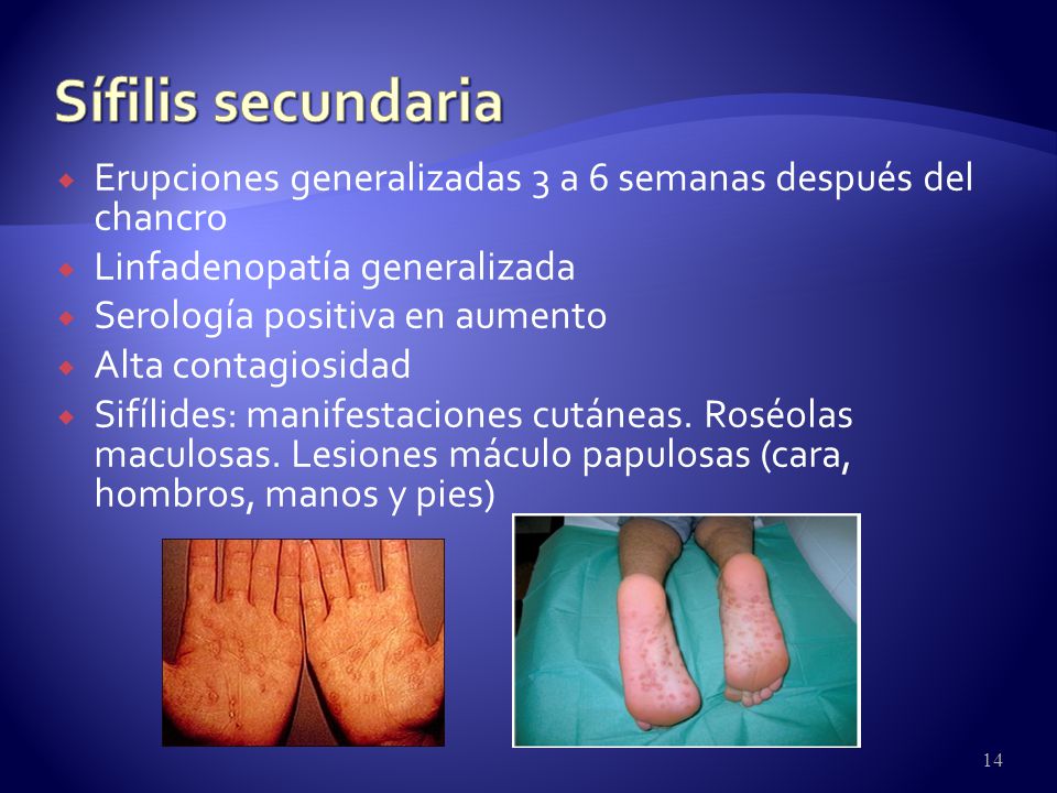 Sífilis secundaria Erupciones generalizadas 3 a 6 semanas después del chancro. Linfadenopatía generalizada.