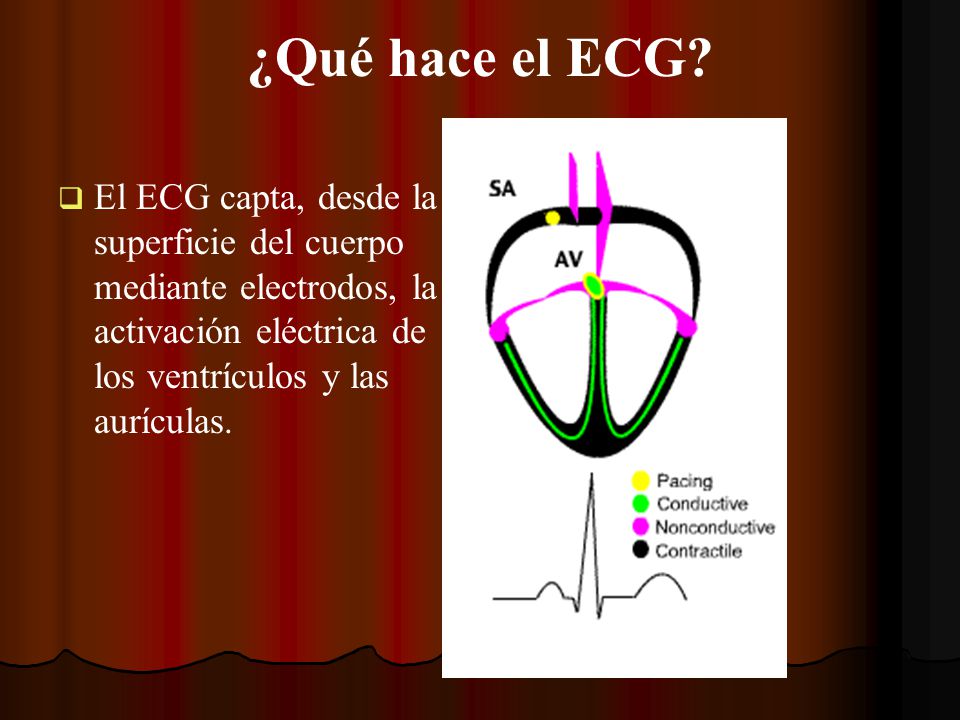 ¿Qué hace el ECG.