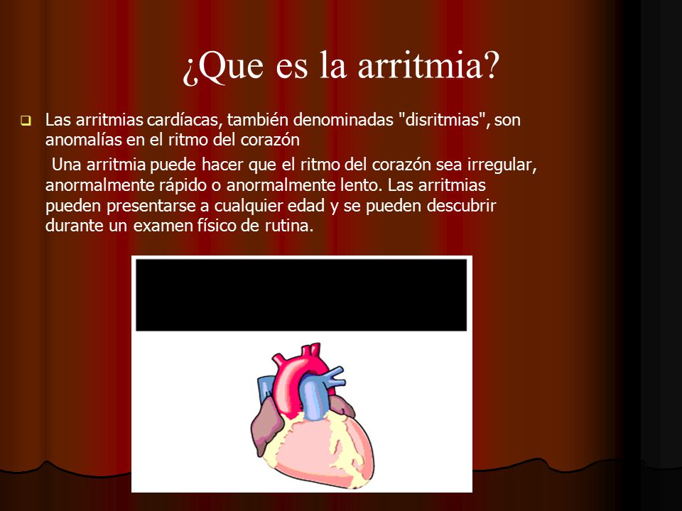 ¿Que es la arritmia Las arritmias cardíacas, también denominadas disritmias , son anomalías en el ritmo del corazón.