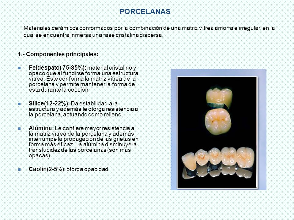 PORCELANAS