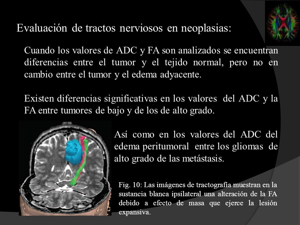 Evaluación de tractos nerviosos en neoplasias: