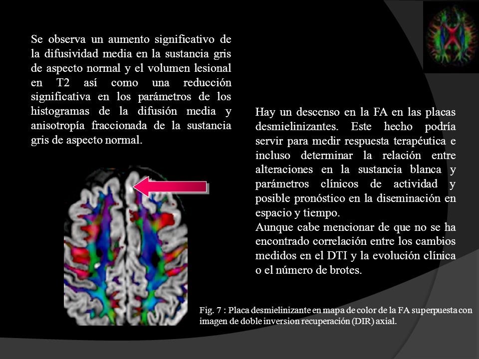 Se observa un aumento significativo de la difusividad media en la sustancia gris de aspecto normal y el volumen lesional en T2 así como una reducción significativa en los parámetros de los histogramas de la difusión media y anisotropía fraccionada de la sustancia gris de aspecto normal.