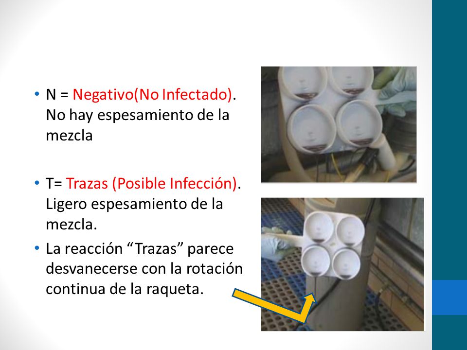 N = Negativo(No Infectado). No hay espesamiento de la mezcla