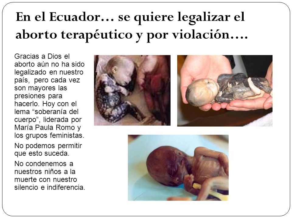 En el Ecuador… se quiere legalizar el aborto terapéutico y por violación….