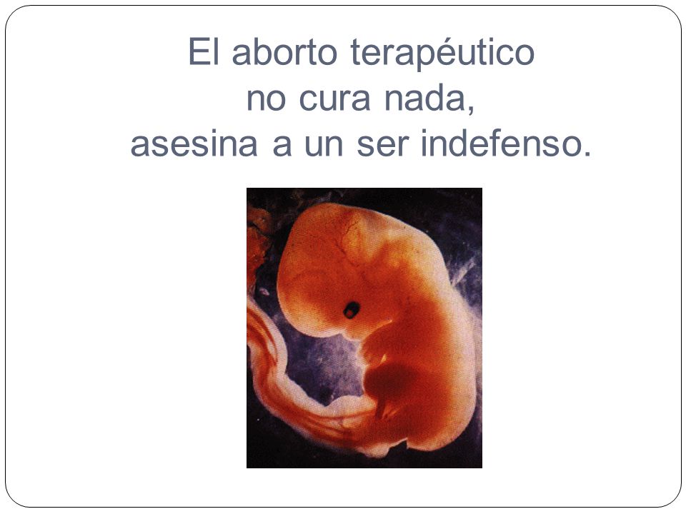 El aborto terapéutico no cura nada, asesina a un ser indefenso.