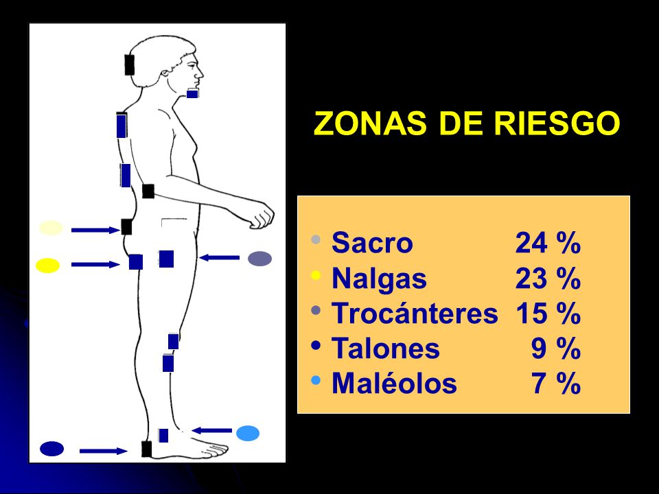 ZONAS DE RIESGO Sacro 24 % Nalgas 23 % Trocánteres 15 % Talones 9 %