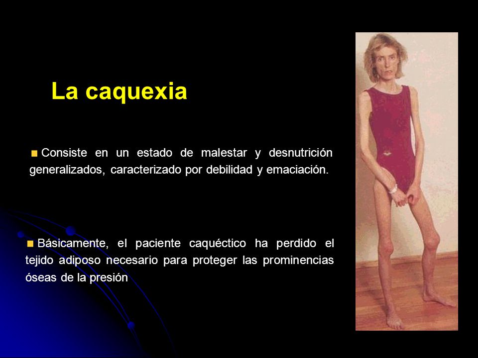 La caquexia Consiste en un estado de malestar y desnutrición generalizados, caracterizado por debilidad y emaciación.