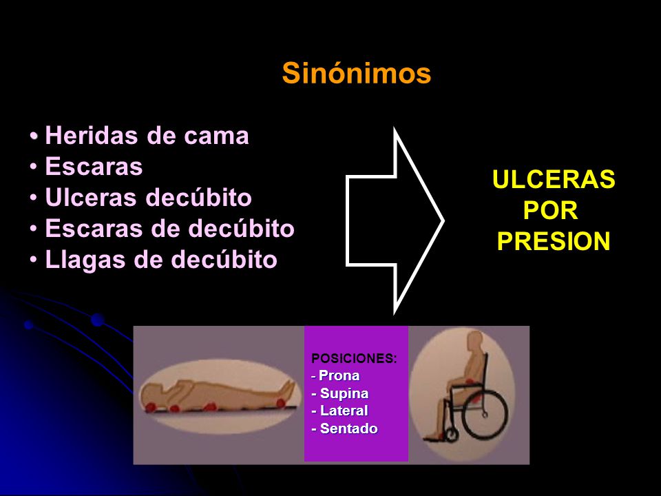 Sinónimos Heridas de cama Escaras Ulceras decúbito Escaras de decúbito