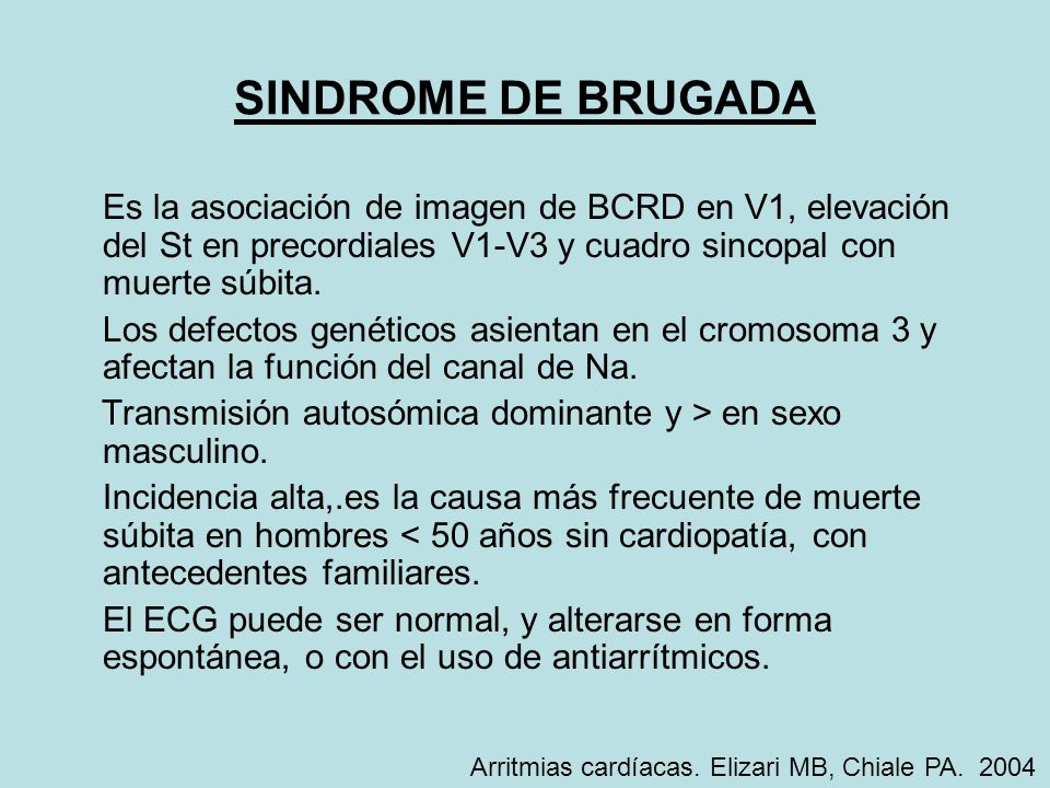 SINDROME DE BRUGADA Es la asociación de imagen de BCRD en V1, elevación del St en precordiales V1-V3 y cuadro sincopal con muerte súbita.