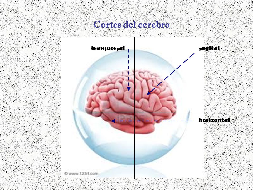 Cortes del cerebro transversal sagital horizontal
