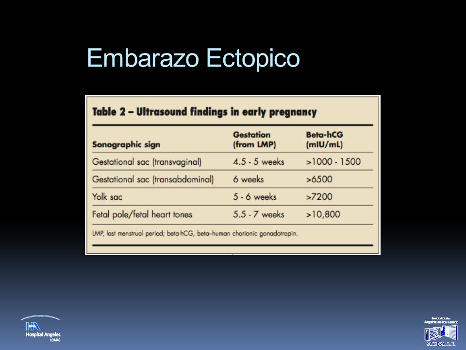 Embarazo Ectopico ultrasound findings which may be seen for ectopic pregnancy. extrauterine sac with a fetal pole with or without cardiac activity.