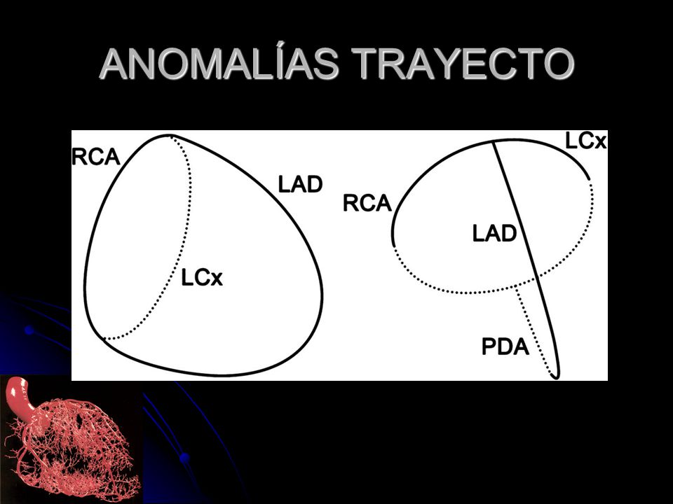ANOMALÍAS TRAYECTO