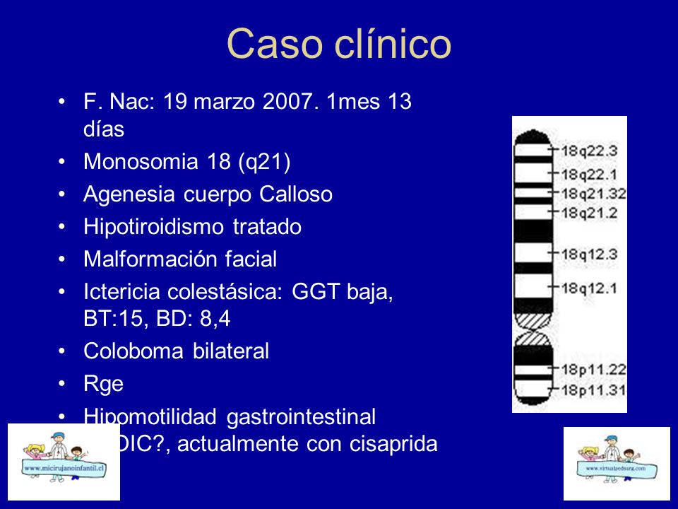 Caso clínico F. Nac: 19 marzo mes 13 días Monosomia 18 (q21)