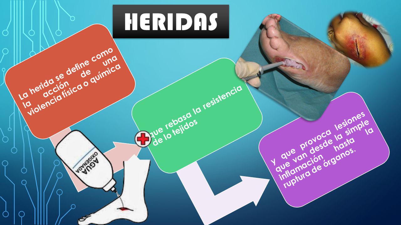La herida se define como la acción de una violencia física o química